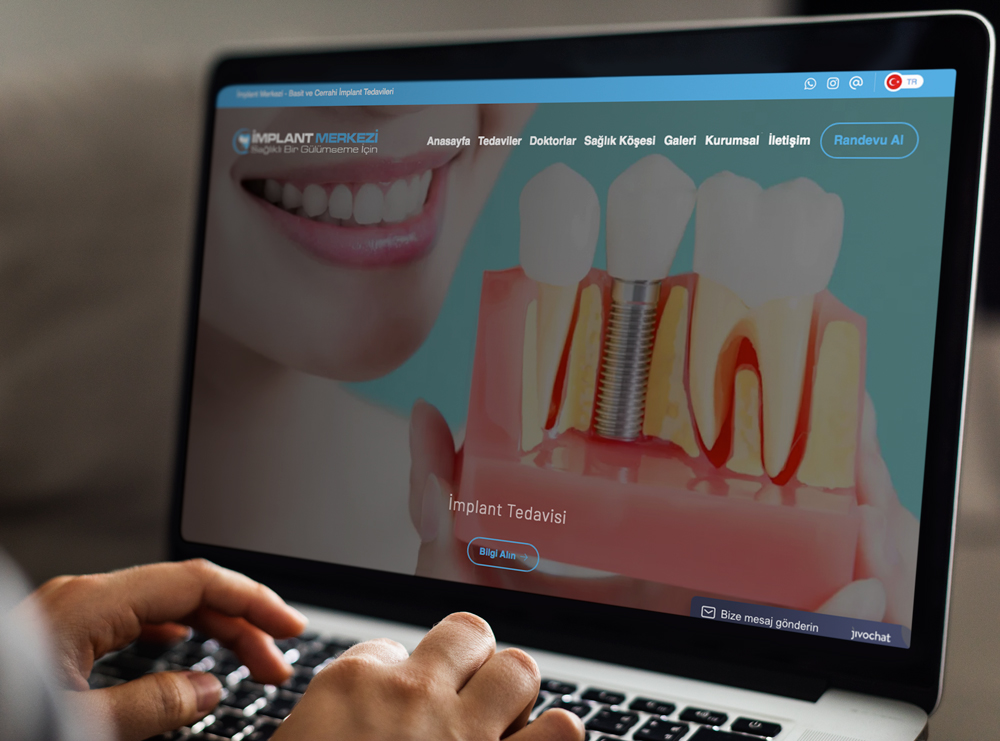 Implant Merkezi 3